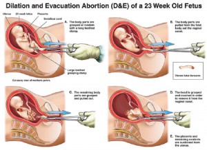 aborcja 3